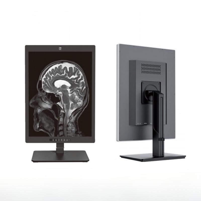 Monitor de diagnóstico médico de 2 MP de 20,1 polegadas