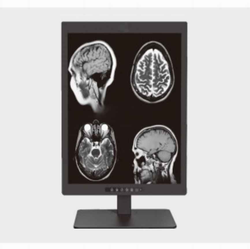 Onde um monitor de diagnóstico médico de 2 MP de 20,1 polegadas é comumente usado?