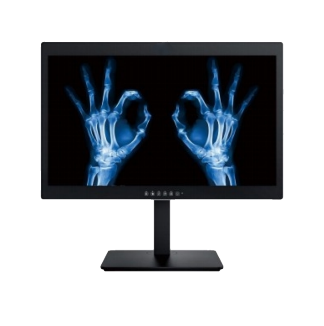 Você acha que os monitores de diagnóstico médico hospitalar de 2 MP e 24 polegadas são apenas monitores de computador comerciais comuns?