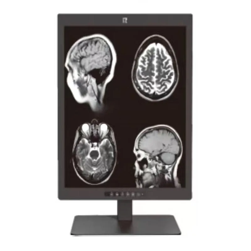Tela de diagnóstico médico de 3 MP de 21,3 polegadas
