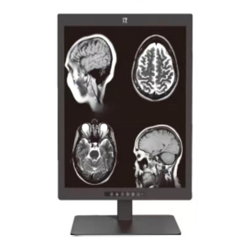 Monitor de diagnóstico médico de 3 MP de 21,3 polegadas