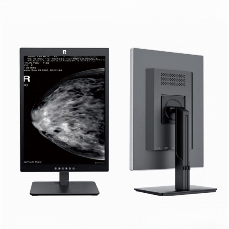 Monitor de diagnóstico médico de 5 MP de 21,3 polegadas