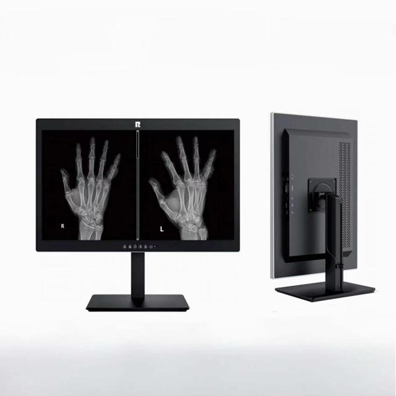 Monitor de diagnóstico médico de 2 MP de 24 polegadas