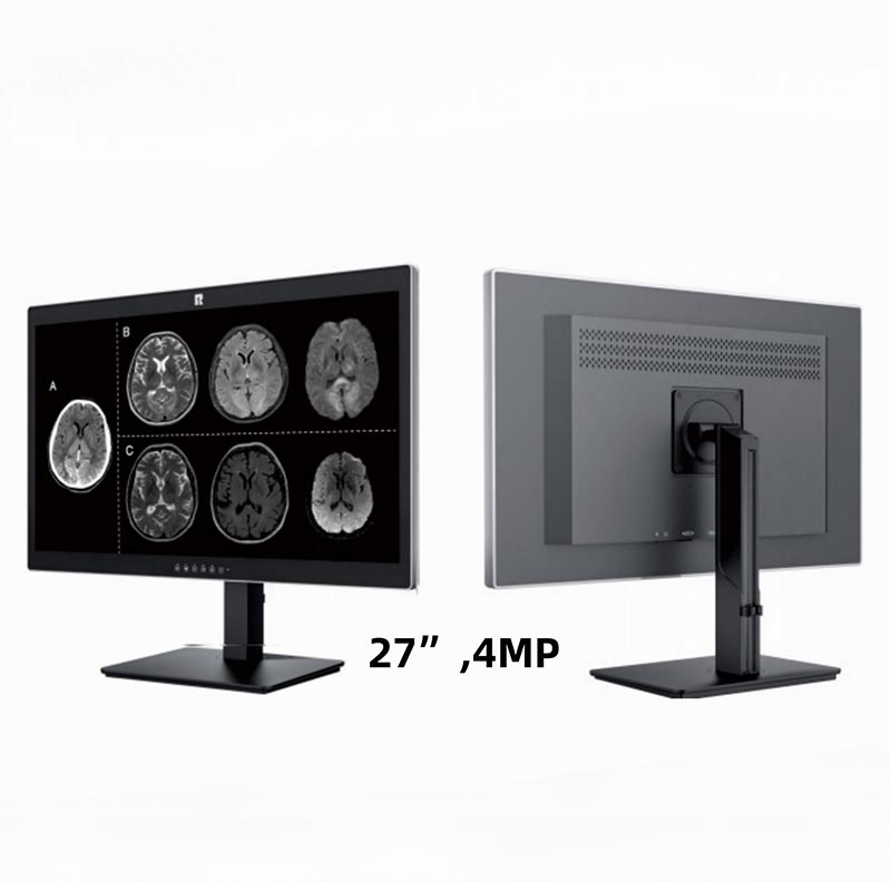 Tela de diagnóstico médico de 27 polegadas e 4 MP