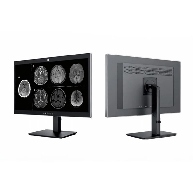Monitor de diagnóstico médico de 8 MP de 27 polegadas