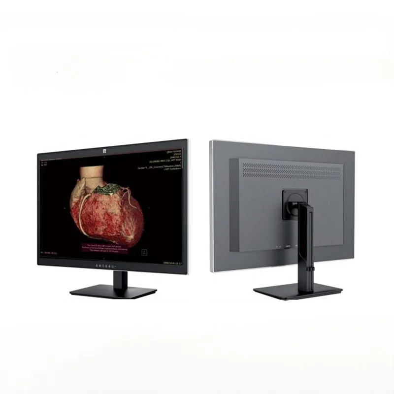 Monitor de diagnóstico médico de 30 polegadas e 6 MP