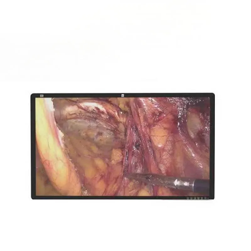 Monitor médico cirúrgico 4K de 32 polegadas