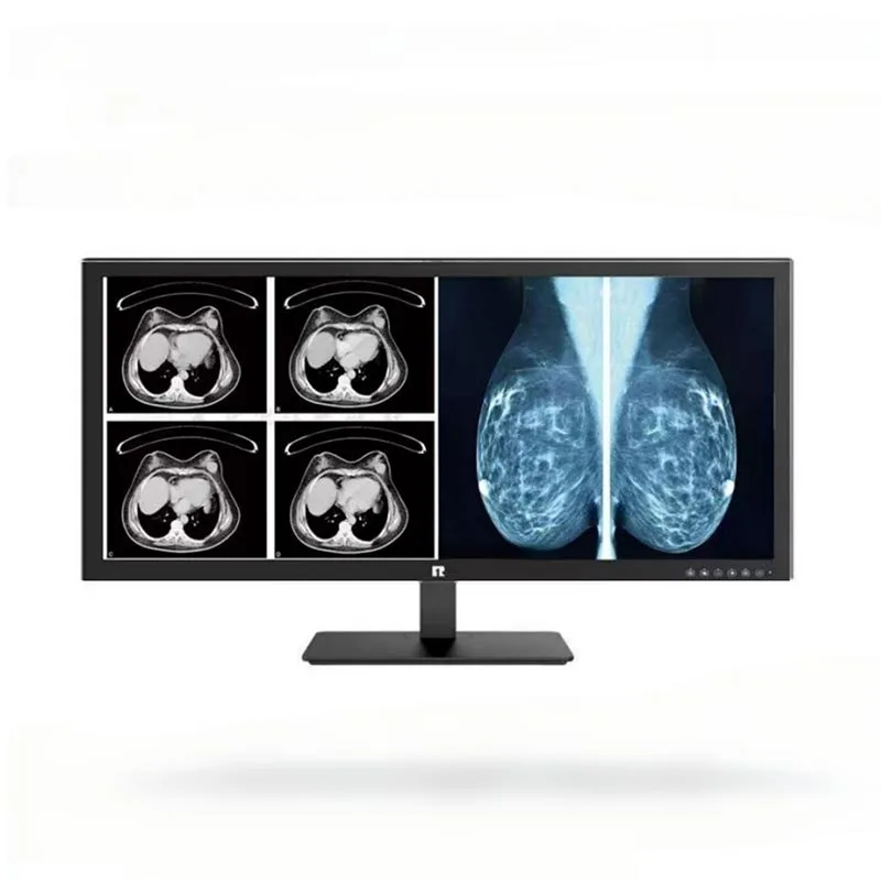 Monitor de diagnóstico médico de 34 polegadas e 5 MP