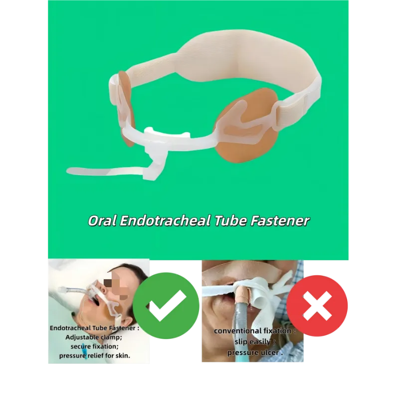 Fixador de tubo endotraqueal