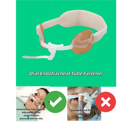 oral endotracheal tube fastener